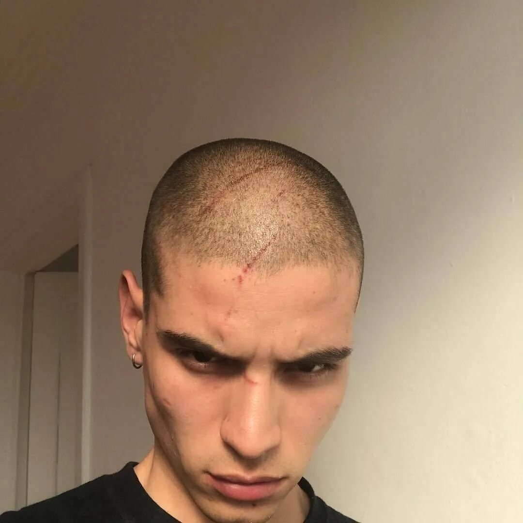 Стрижка наголо мужская. Стрижка налысо. Парень с бритой головой. Стрижка наголо. 3.