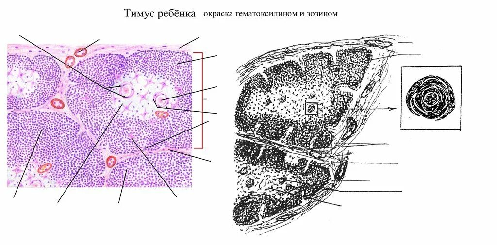 Тимус гистология. Тимус гистология препарат. корковое вещество тимуса гистология препарат. тимус гистология клетки няньки. тимус гистология препарат лимфоциты.