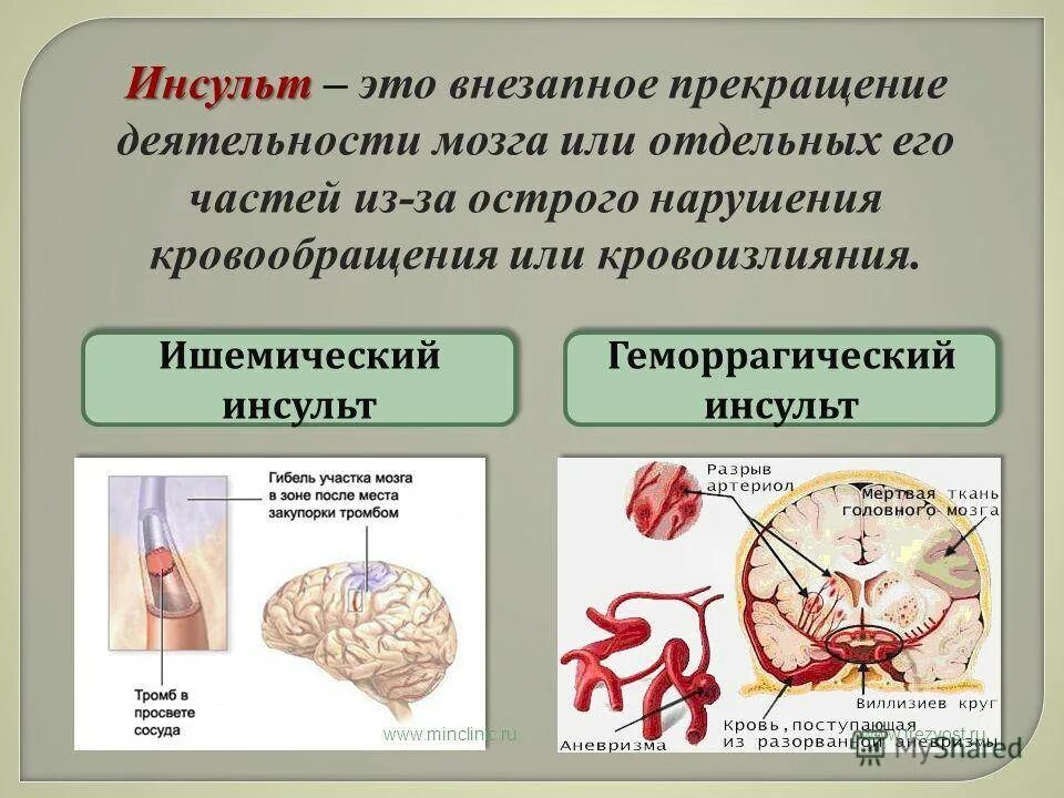 Острые нарушения системы кровообращения