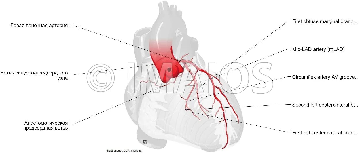Гипоспадия венечной борозды. Венечная борозда у мужчин. Венечная борозда у мужчин. Гипоспадия дистальная форма. Венечная борозда на поверхности сердца.