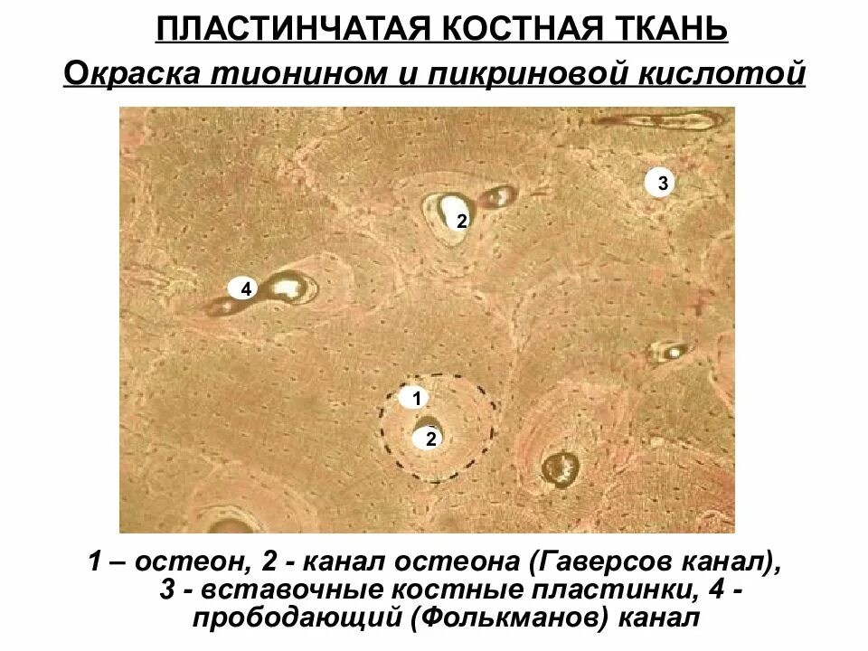 Костная ткань гистология препарат. Пластинчатая костная ткань препарат гистология. Костная ткань гистология микропрепарат. Пластинчатая костная ткань окраска Тионин пикриновая кислота.