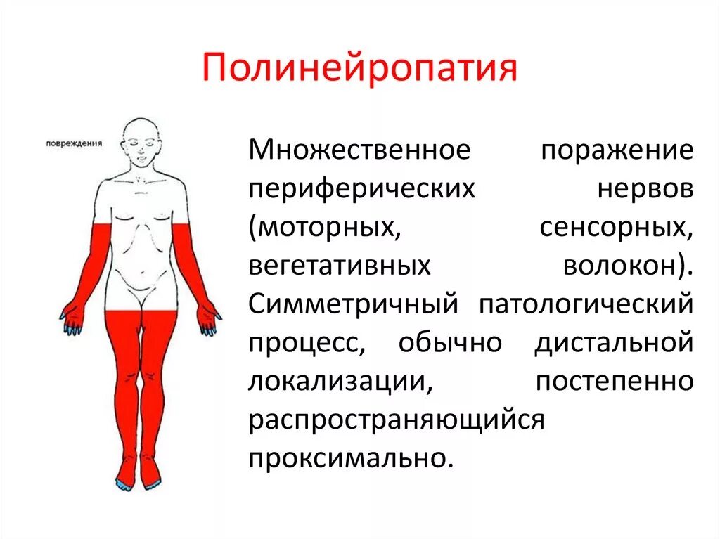 Диабетическая периферическая полинейропатия симптомы. Дистальные отделы нижних конечностей полинейропатия. Диабетическая дистальная сенсорная полинейропатия. Полинейропатия клиническая картина. Обезболить нейропатию