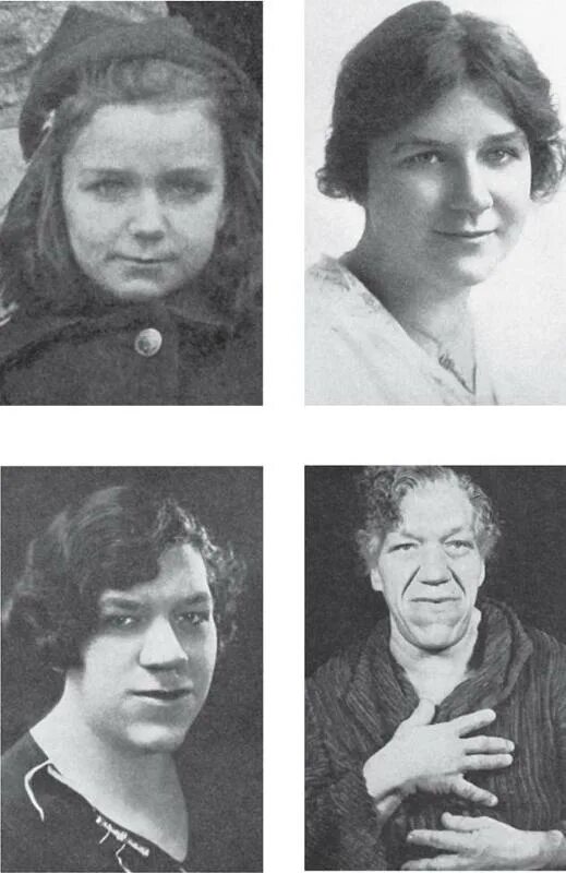 Гипофиза симптомы у женщин лечение прогноз. Аденома гипофиза акромегалия. аденома гипофиза симптомы у женщин. опухоль гипофиза симптомы у женщин.