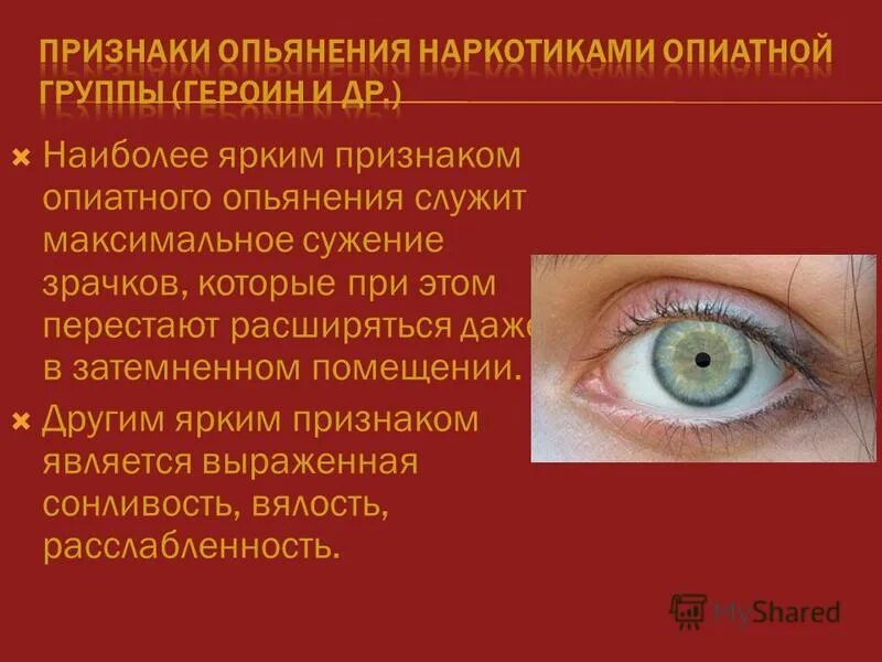 Изменение зрачков характерны. От героина сужаются зрачки. Глаз расширенный зрачок. Сужение зрачка обеспечивает. Сужение зрачка обеспечивает.