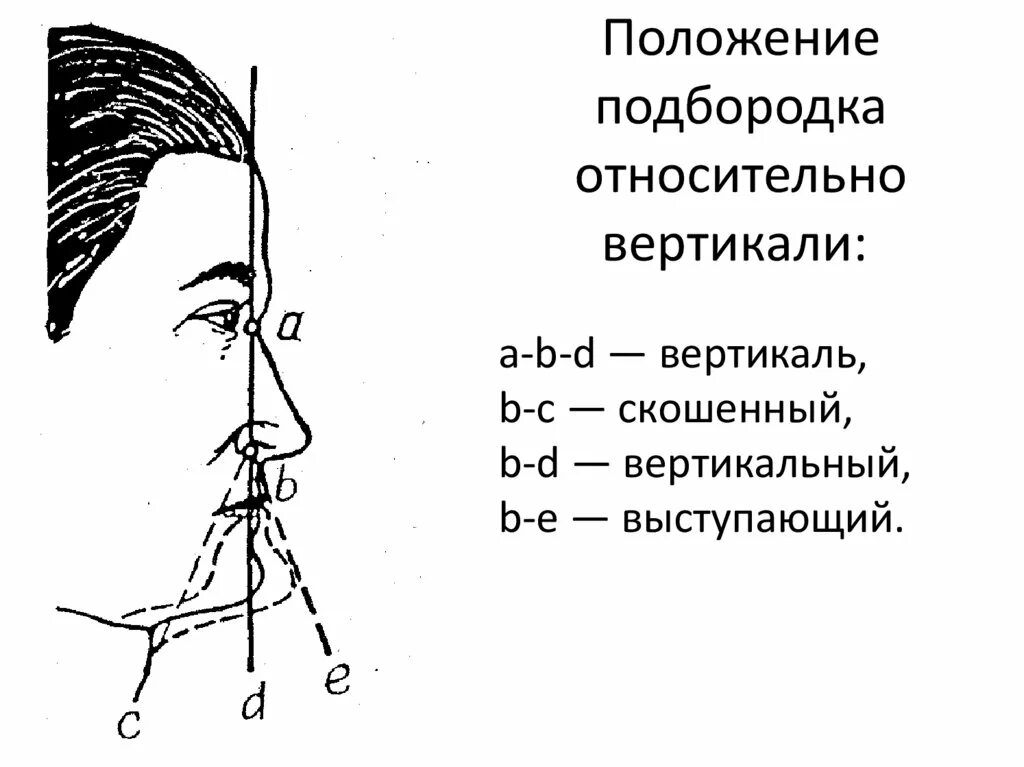 Название лбов. Подбородок криминалистика. Подбородок по положению. Положение подбородка криминалистика. Разновидности подбородков.