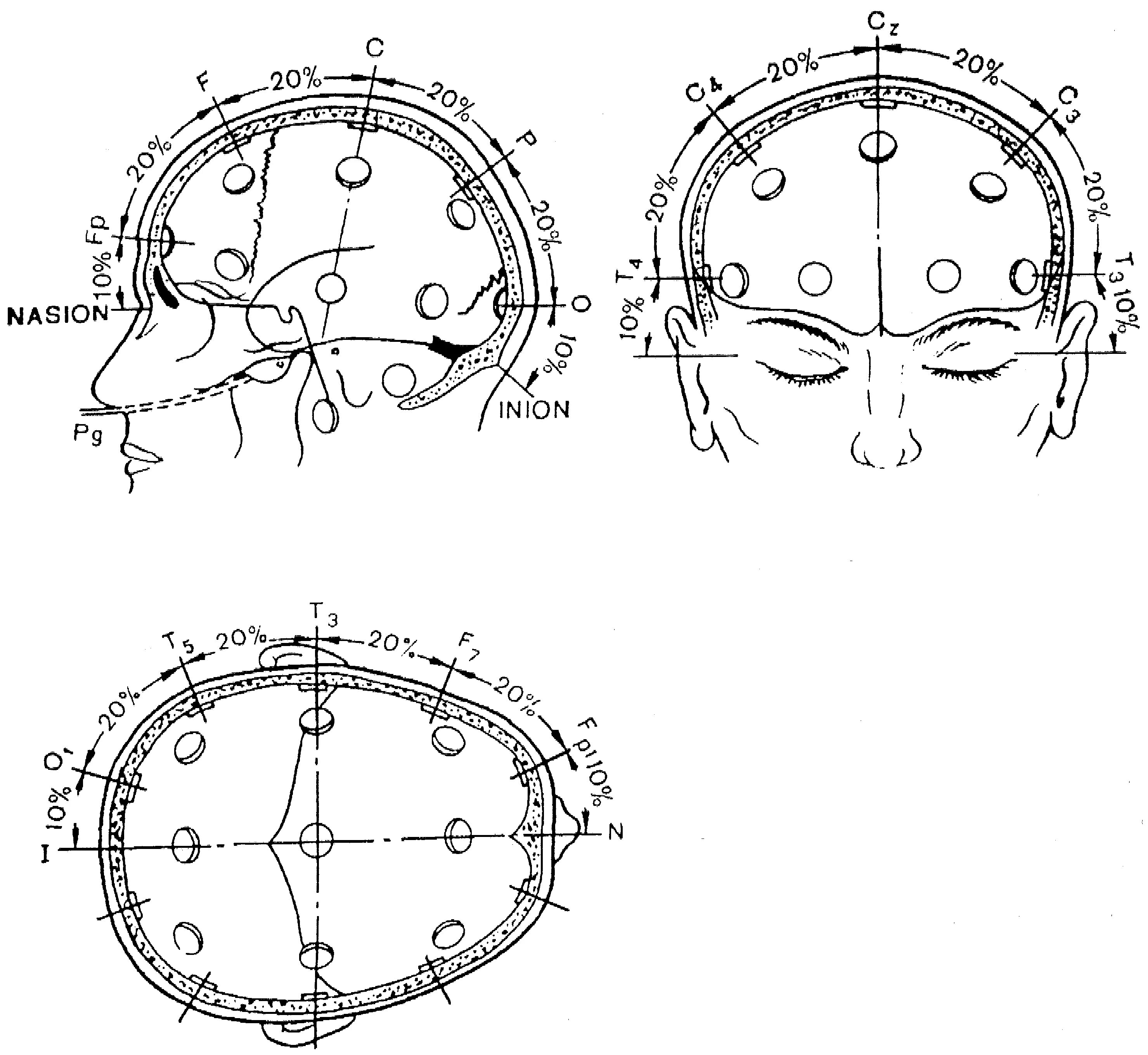 Система ээг. Схема расположения электродов при ЭЭГ 10-20. 10-10 Схема ЭЭГ. ЭЭГ наложение электродов схема 10-20. Международная схема электродов ЭЭГ 10-20.