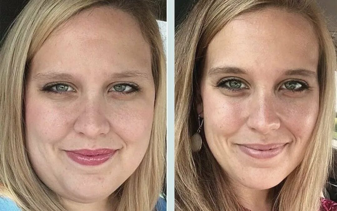 Толстое лицо до и после. Лицо до и после похудения. Лица людей до и после похудения. Изменение лица после похудения. Установленных до и после