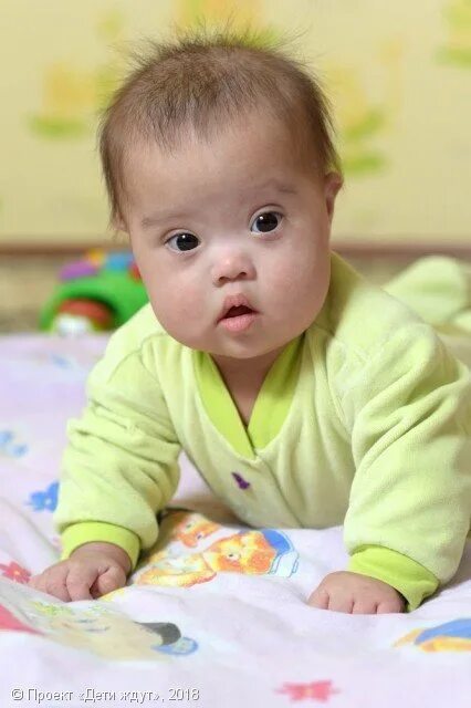 дети усыновление воронеж