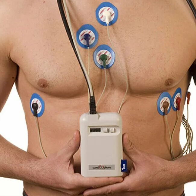 холтер воронеж. холтер экг и ад. холтер мониторинг сердца. холтеровское мониторирование экг. холтер монитор.