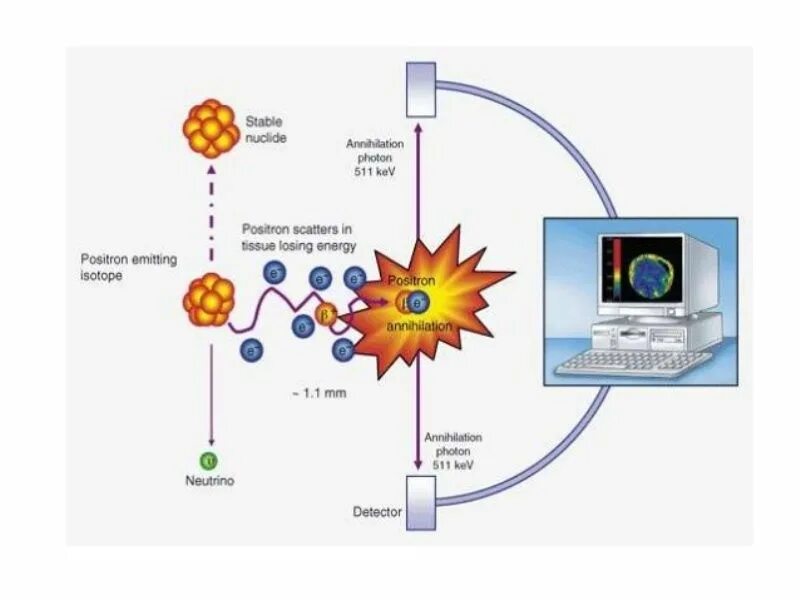 Позитрон личный кабинет. Позитрон. Positron emission. Positron emission tomography. Позитрон картинка.