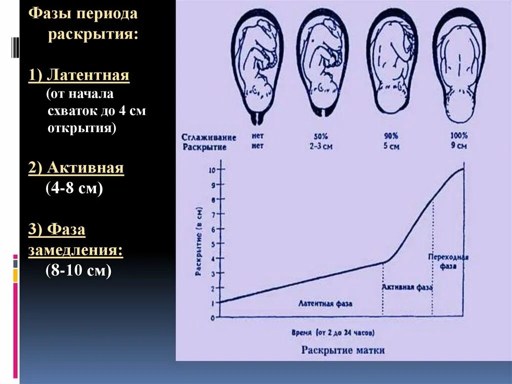 Шейка на 24 неделе. Фазы периода раскрытия шейки матки. Раскрытие шейки матки 3-4 см. Раскрытие шейки матки 8 см. Шейка матки раскрытие 2 пальца.