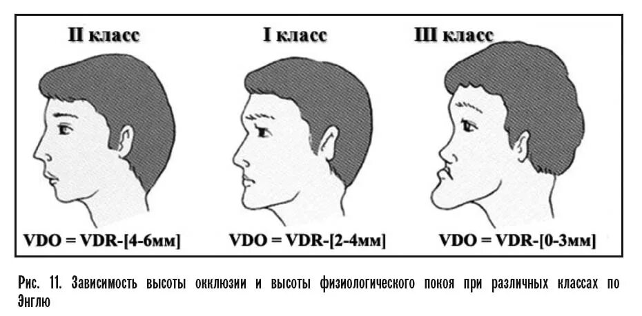 Как держать язык во рту. Правильное положение языка. Правильная позиция языка. Неправильное положение языка. Правильное положение языка во рту.