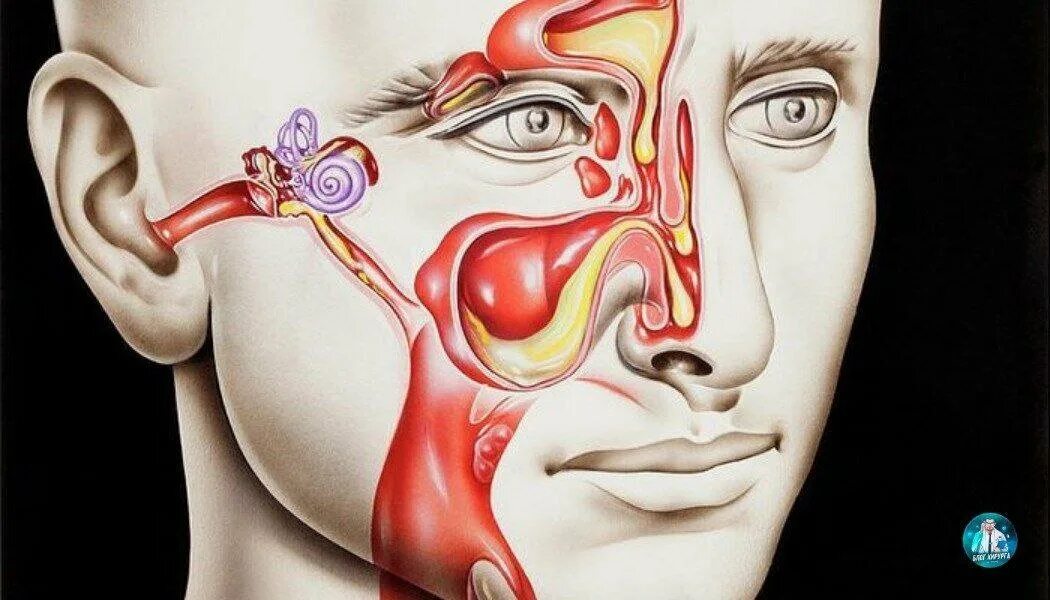 Простуда уха носа. Анатомия гайморовой пазухи человека. Пазухи носа анатомия гайморит. Евстахиева труба и гайморова пазуха.