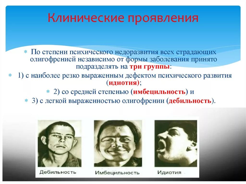 Степень умственной отсталости идиот. Дебильность Имбецильность идиотия. Классификация умственной отсталости идиотия. Три степени олигофрении:идиотия, Имбецильность, дебильность у детей.