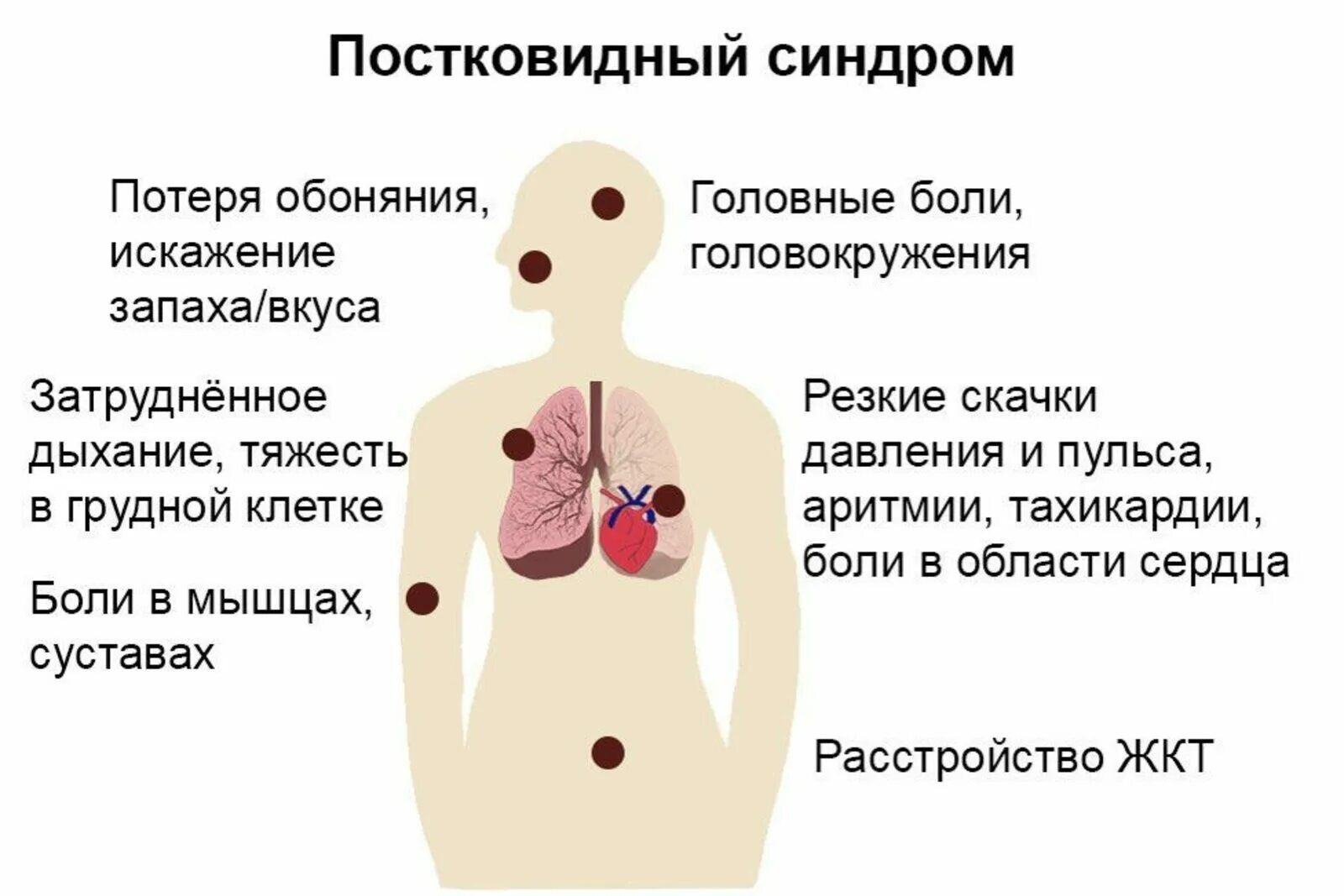 Симптомы ковида у взрослых в 2024 году. Постковилдный синдром. Посткови́д6ый СИ́НДРОМД. Симптомы постковидного синдрома. Постковтдный синдром симптомы.