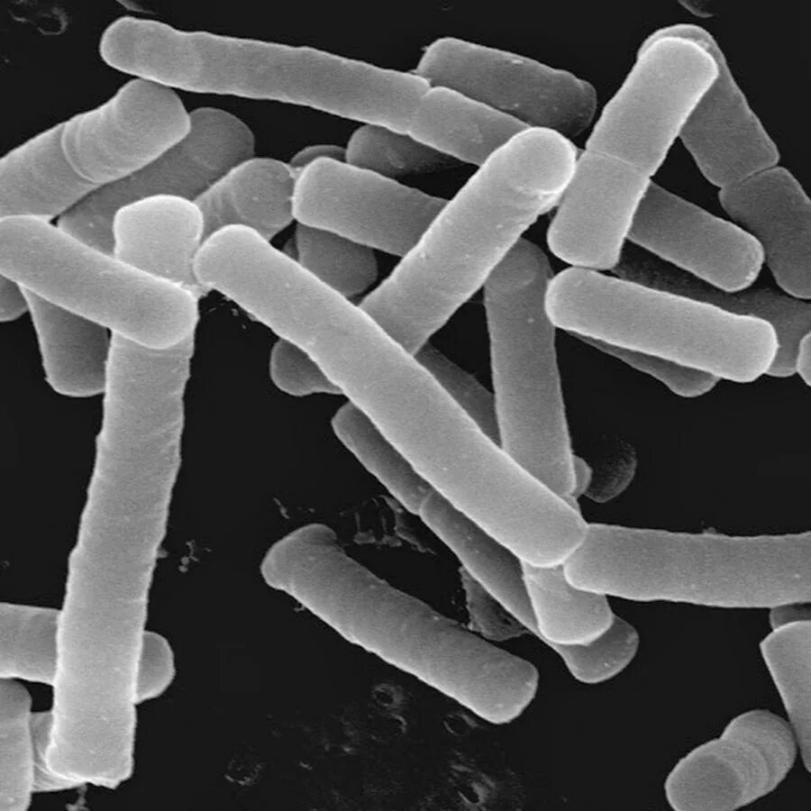 Lactobacillus helveticus. Молочнокислые бактерии лактобациллы. Lactobacillus – (молочнокислые палочки) -. Lactobacillus rhamnosus hn001. Микробиологические на аэробные микроорганизмы