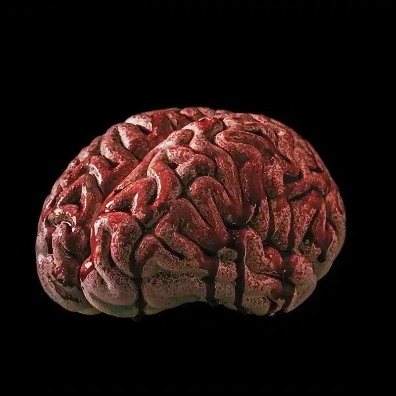 Want brains