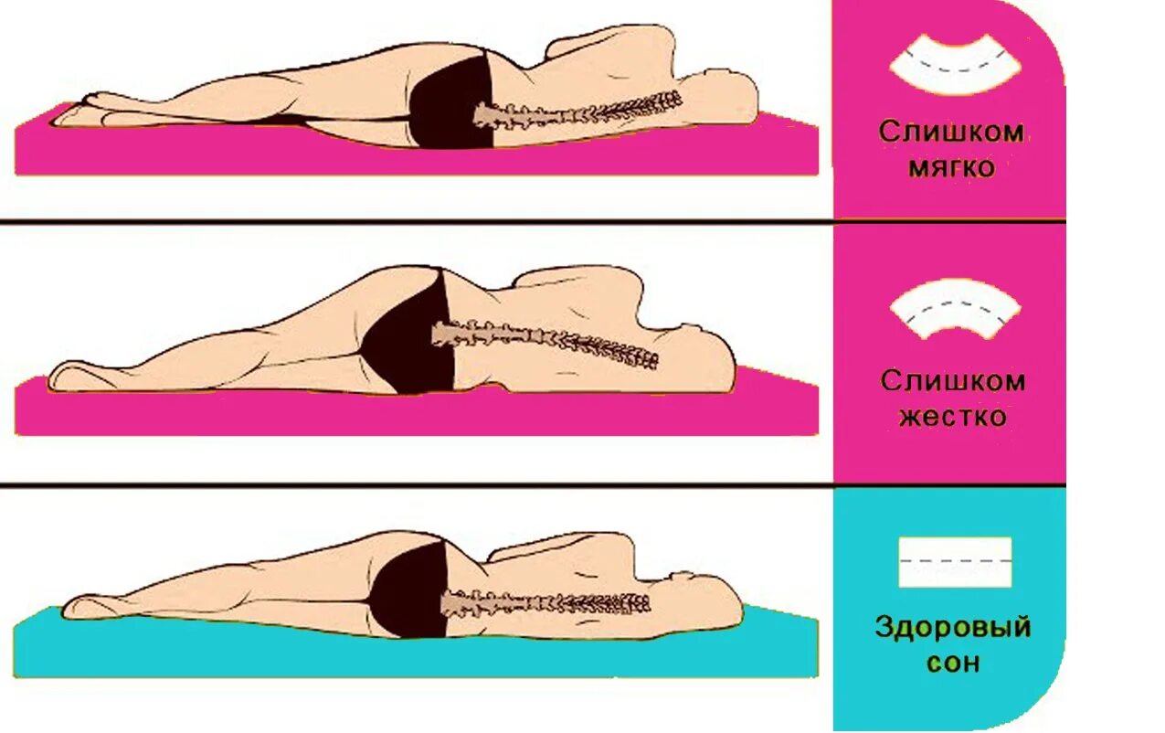 Спать на мягком матрасе. Жесткость матраса. Слишком мягкий матрас. Спать на жестком.