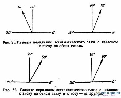 Транспозиция астигматических