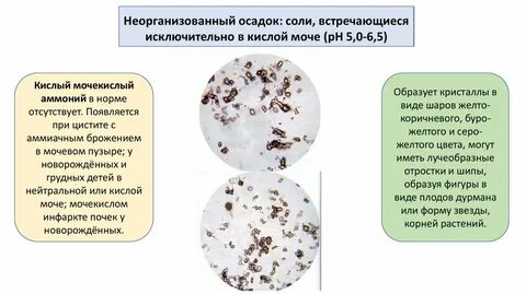 Почему моча соленая
