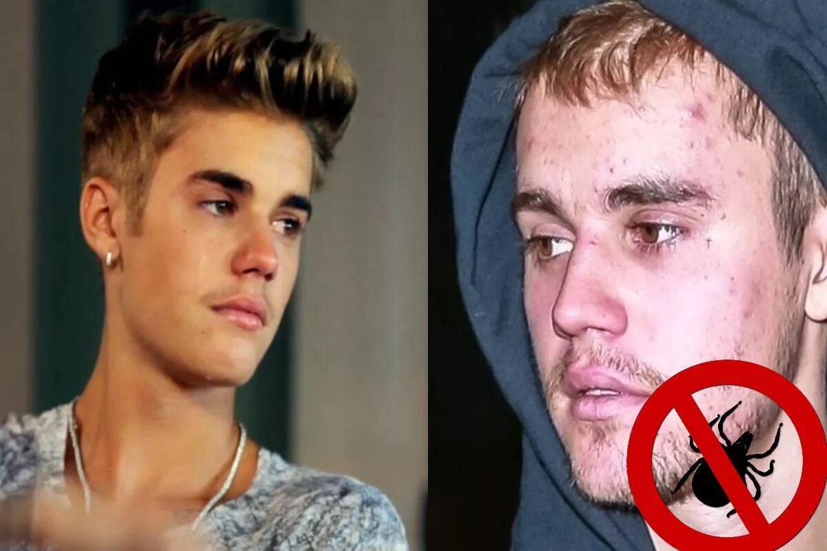 Justin bieber 2022. Джастин бибер и хейли. Бибер стал жертвой насилия. Джастин бибер 2021 и хейли. Джастин бибер с отцом.
