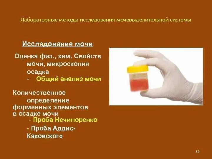 Моча кратко