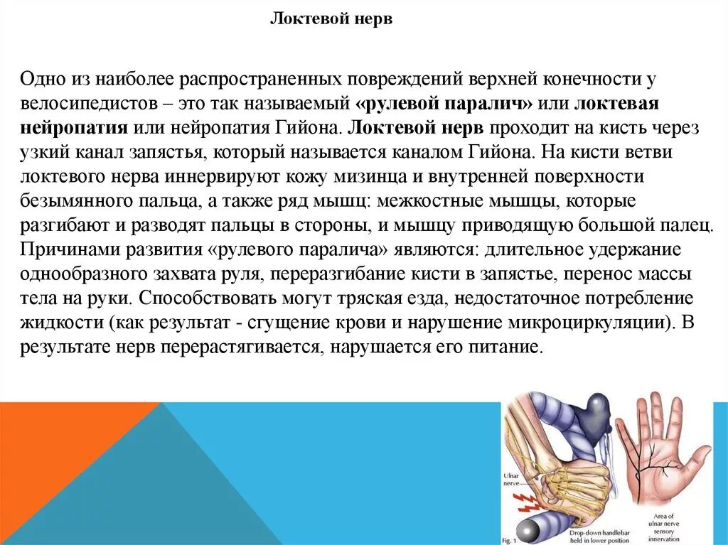 Нейропатия локтевого нерва. Нейропатия локтевого нерва ЛФК. Нейропатия локтевого нерва упражнения.