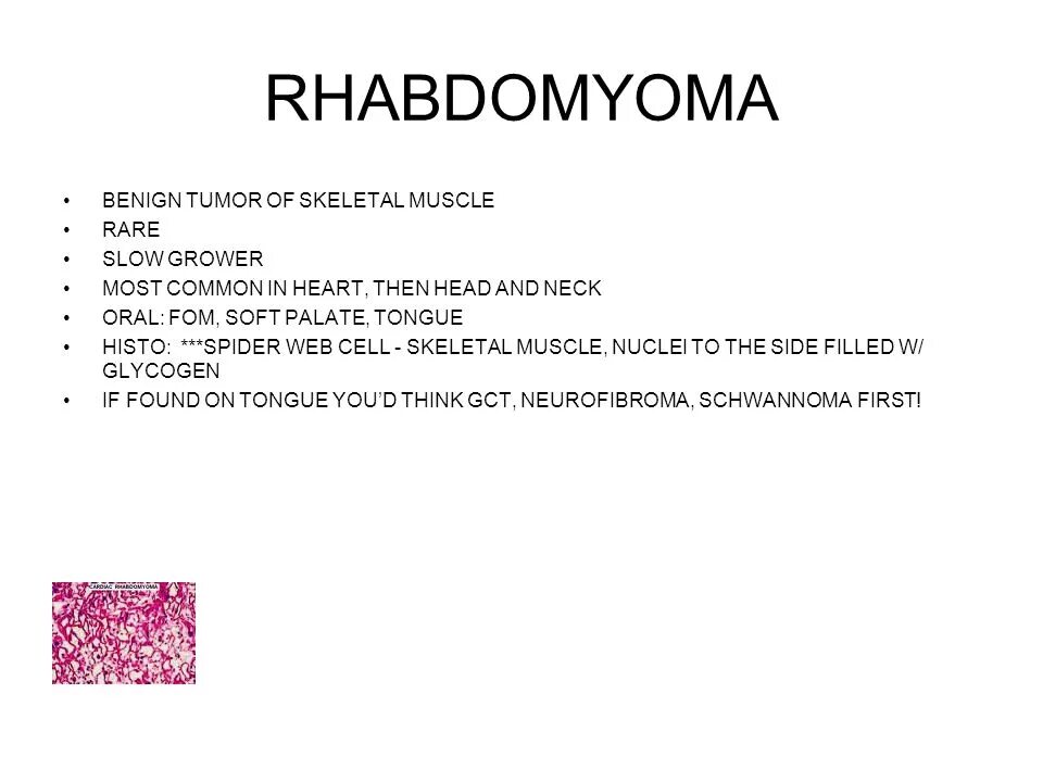 Рабдомиома сердца. Рабдомиома характеристика. Рабдомиома характеристика патанатомия.