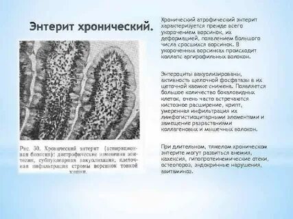 Хронический энтерит