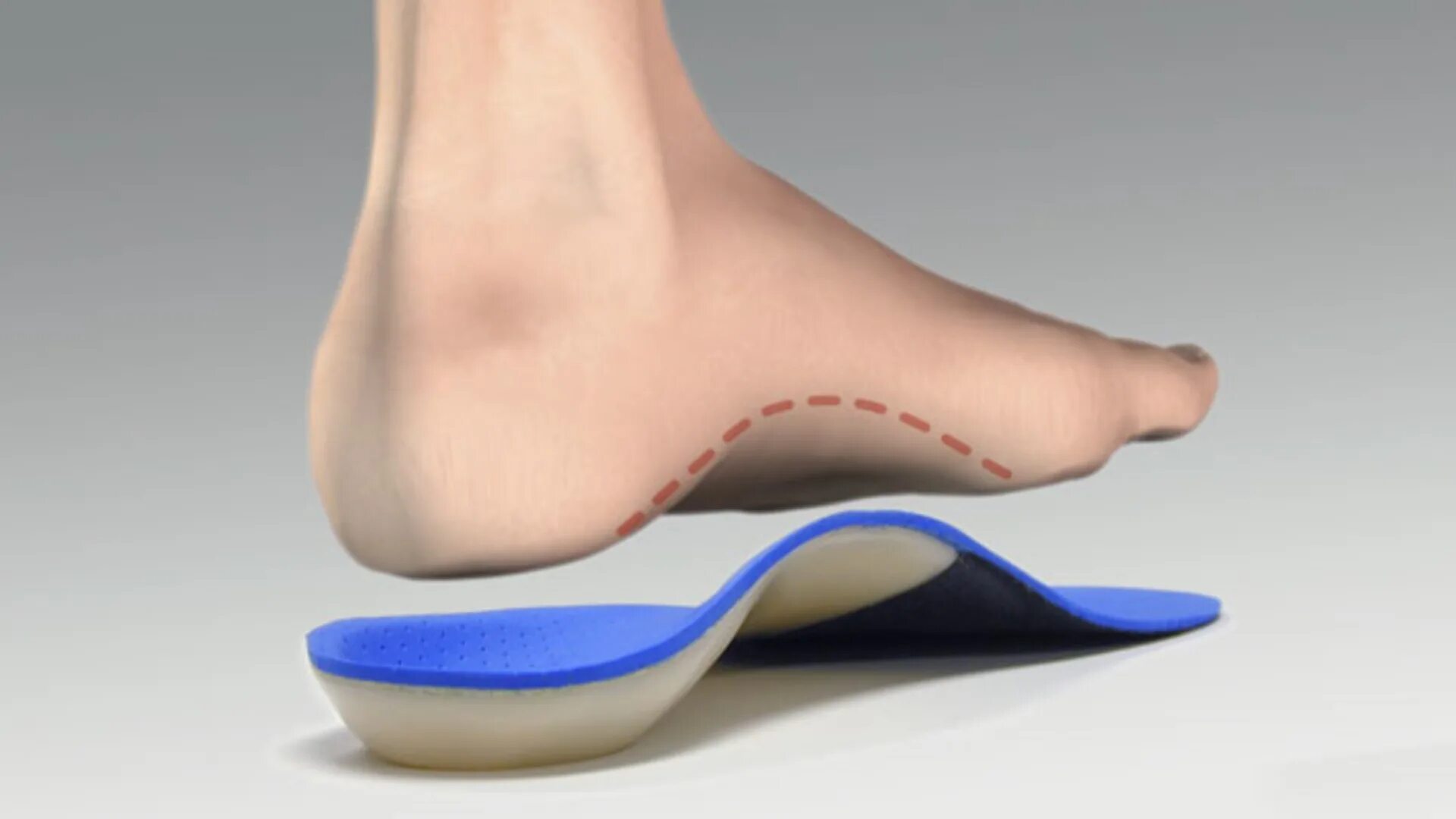 Spread feet. Стелька ортопедическая Орто доктор d010. Ортопедические стельки при вальгусной деформации. Стельки ортопедические lum101n.