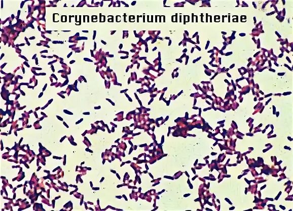 Corynebacterium spp в мазке у мужчин. Corynebacterium diphtheriae окраска по граму. corynebacterium diphtheriae морфология. морфология коринебактерий дифтерии. коринебактерии дифтерии по граму.
