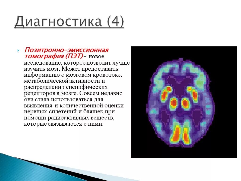 Позитронно-эмиссионная томография мозга (ПЭТ). Позитронно-эмиссионная томография презентация. Позитронно-эмиссионный томограф. Метод позитронно-эмиссионной томографии. Метаболическая активность на пэт