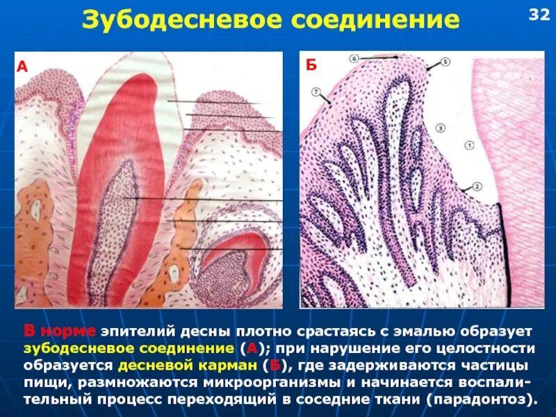 Слои полости рта. Зубодесневое соединение гистология. Зубодесневое прикрепление гистология. Периодонт гистология препарат. Зубодесневое соединение гистология препарат.