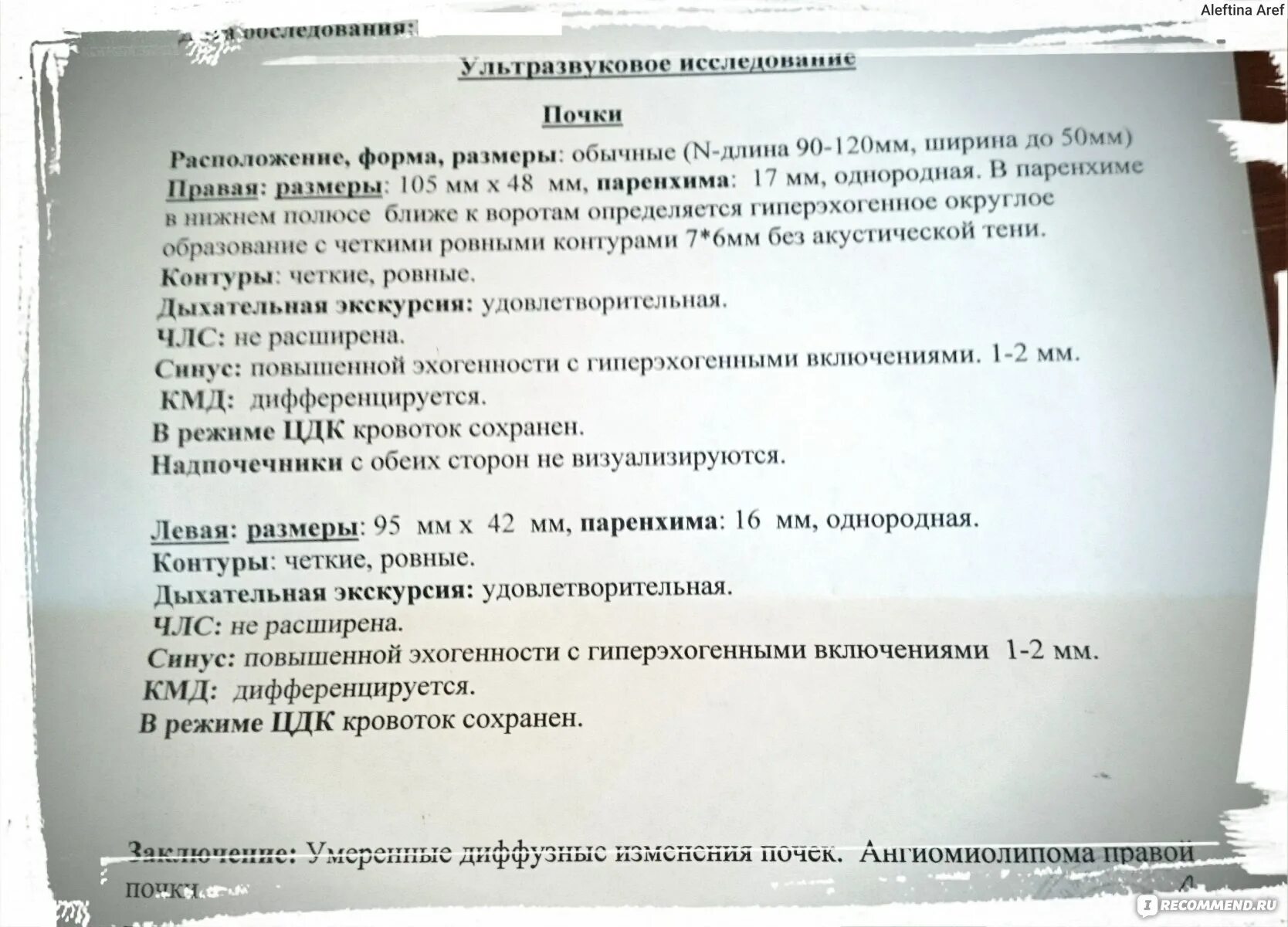 Нужно ли перед узи почек пить воду. УЗИ почек и мочевого пузыря нормальные показатели. УЗИ почек заключение норма. УЗИ почек протокол норма. УЗИ почек ребенку в 1 месяц протокол УЗИ.