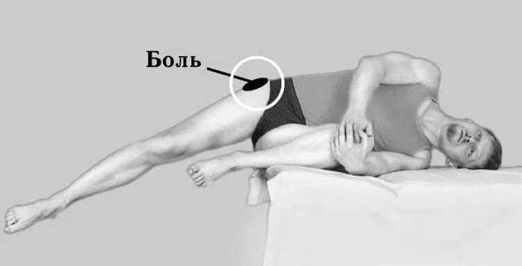 Почему боли в тазобедренном суставе. Болит внешняя сторона бедра. болит бедро в тазобедренном суставе. болит наружная сторона бедра. болят ноги с наружной стороны бедра.