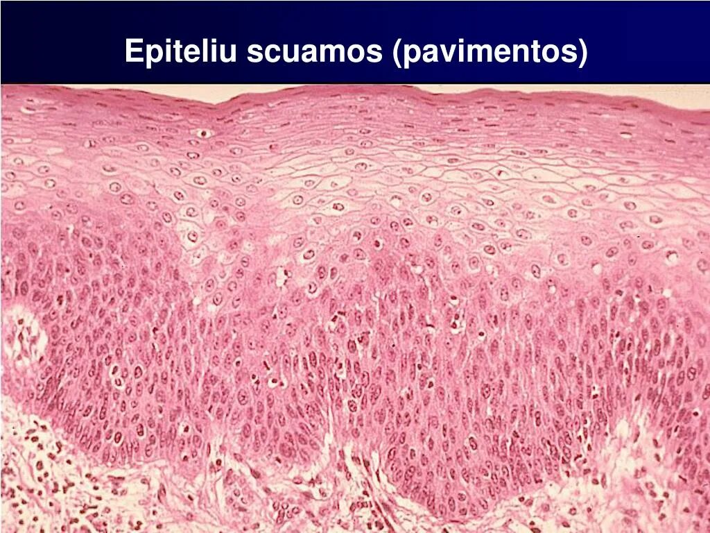 эпителиальная ткань микроскоп. мерцательный эпителий гистология. эпителиальная ткань микрофотографии. эпителиальная ткань микроскоп. эпителиальная ткань микроскоп.