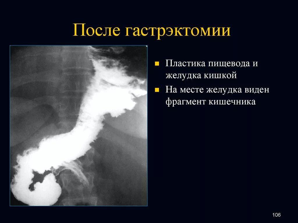 Форма пищевода