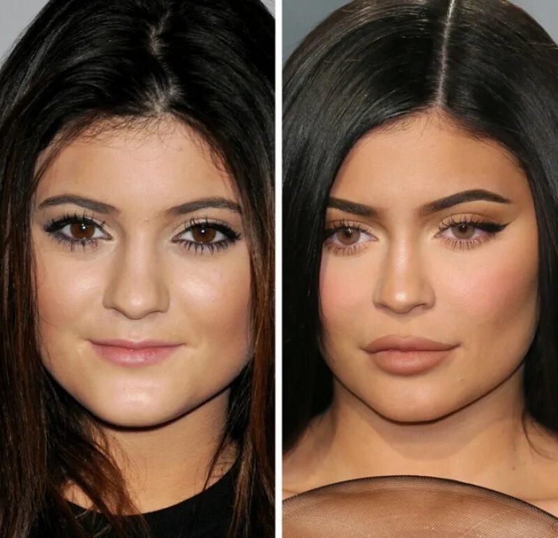 Ирина шейк светлые брови. Megan fox до операции. Как губы меняют лицо фото. Кайли кардашьян до пластики. Кайли дженнер до пластики.