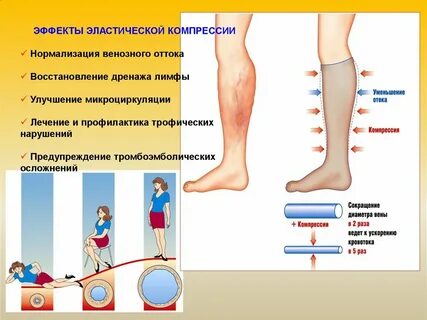 Рекомендации после операции вен