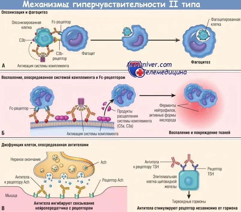 Иммунная гиперчувствительность. Механизм гиперчувствительности 2 типа. Гиперчувствительность 2 типа иммунология схема. Механизм 2 реакции гиперчувствительности. 2 Тип гиперчувствительности цитотоксический.