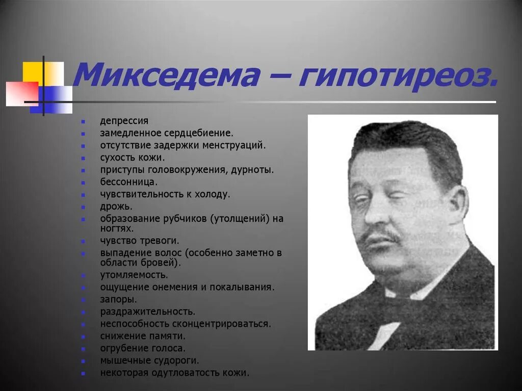 Претибиальная микседема при гипотиреозе. Микседема что за болезнь