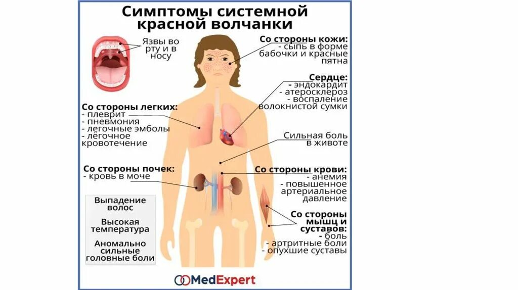 Симптомы и признаки красной волчанки