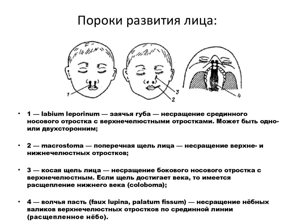 Пороки развития головы Макростомия. Врожденные пороки развития лица и шеи причины. Хирургическая анатомия врожденных пороков развития лица. Пороки развития области шеи классификация.