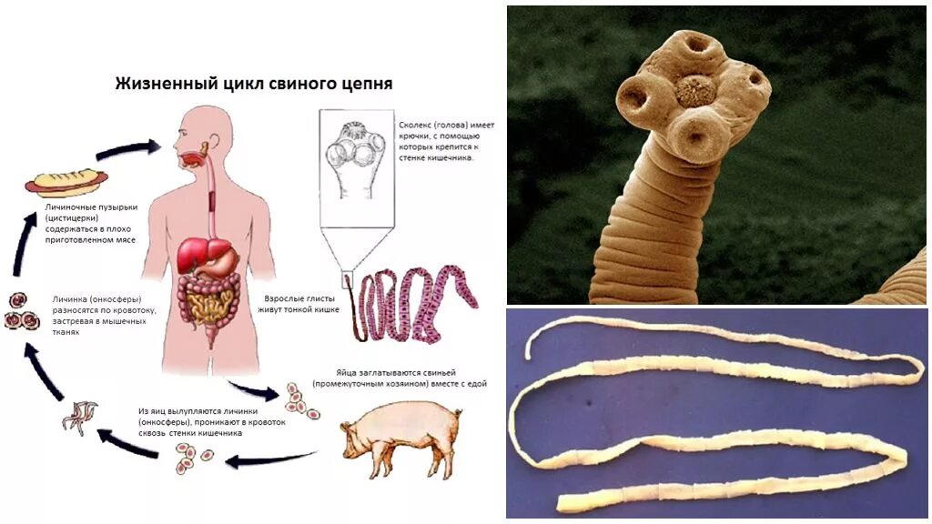 Ленточные жизненный цикл. Паразиты свиной цепень черви. Taenia solium жизненный цикл. Ленточные черви бычий цепень. Ленточные черви жизненный цикл свиного цепня.