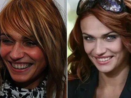 Водонаева до и после пластики