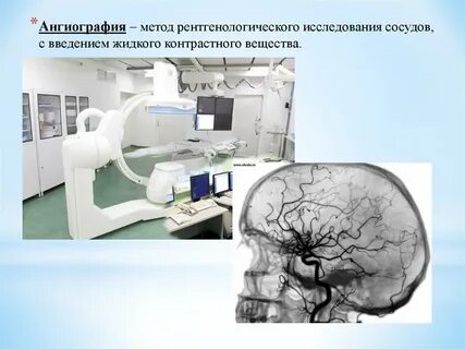 Ангиография с контрастом сосудов