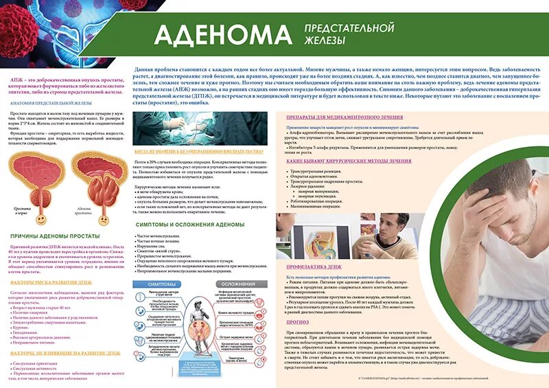 Простат аденом отзывы. Санбюллетень аденома предстательной железы. профилактика аденомы предстательной железы. доброкачественная гиперплазия предстательной железы профилактика. профилактике гиперплазии простаты.
