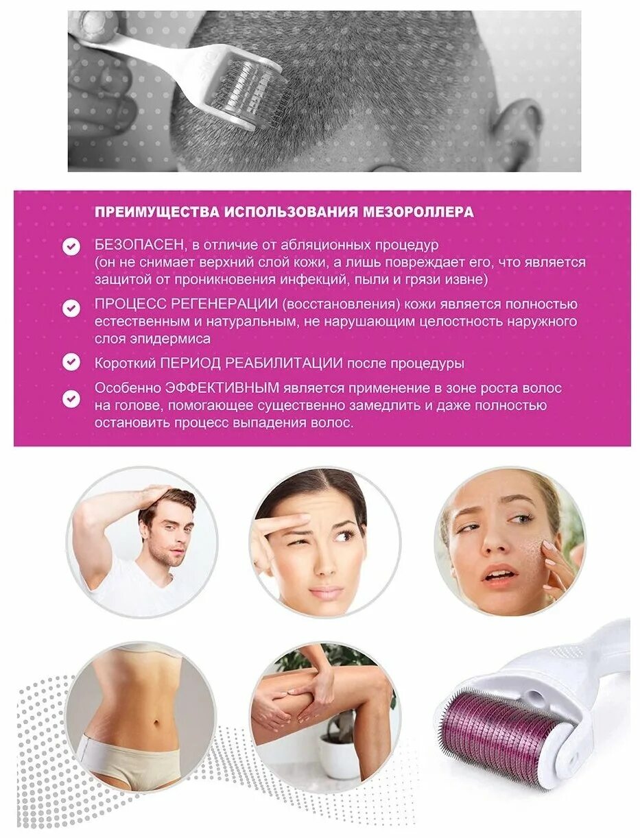Мезороллер zgts с титановыми иглами, 540 игл. Мезороллер размер игл для волос. Мезороллер (длина игл: 0,3 мм) 4/22. Мезороллер на волосах на голове. Мезороллер 0 5 мм схема.