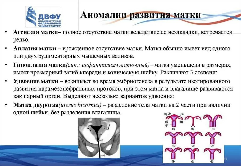 Врожденные пороки развития матки. Аномалии матки классификация. Врожденные пороки развития шейки матки.