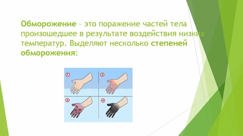 Обморожение определение. Обморожение частей тела. обморожение первой степени.